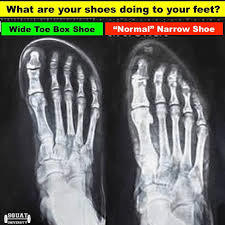 Image of the wide toe and narrow toe box of shoes